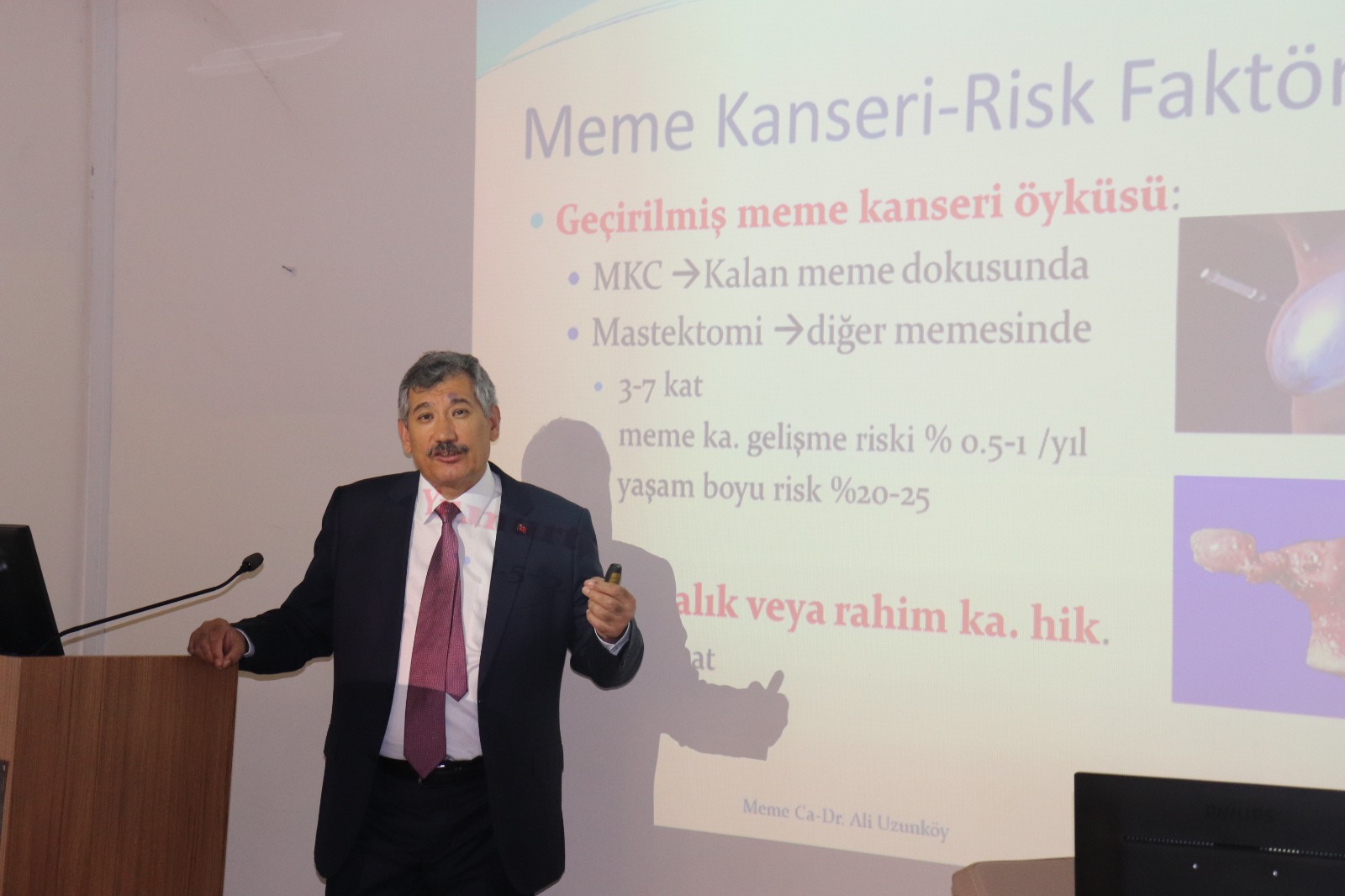 PROF. DR. UZUNKÖY: “MEME KANSERİ ERKEN TANIYLA ÖNLENEBİLEN VE TEDAVİ EDİLEBİLEN BİR HASTALIKTIR”